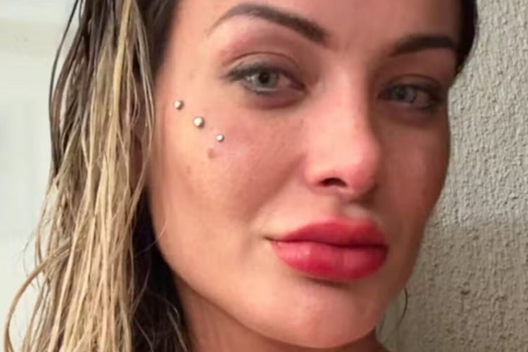 O desabafo de Andressa Urach após fazer cirurgia proibida no Brasil