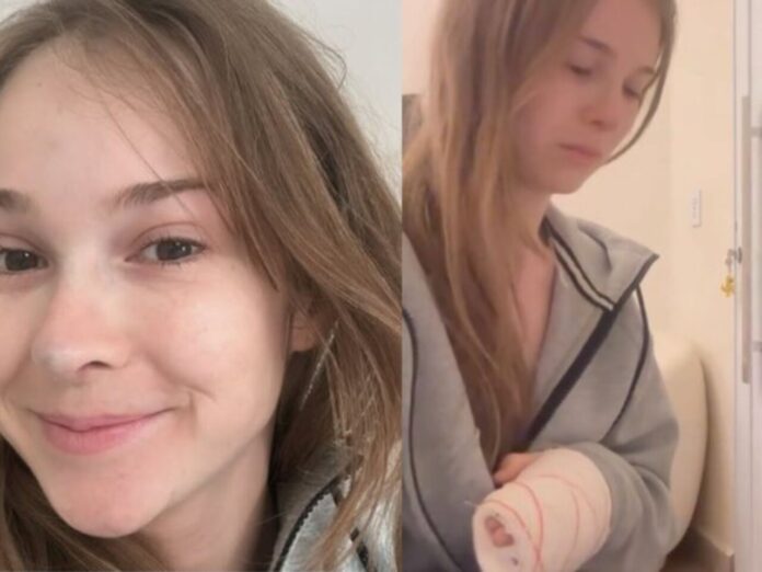 Sammy Lee fratura a mão em acidente (Foto: Reprodução)