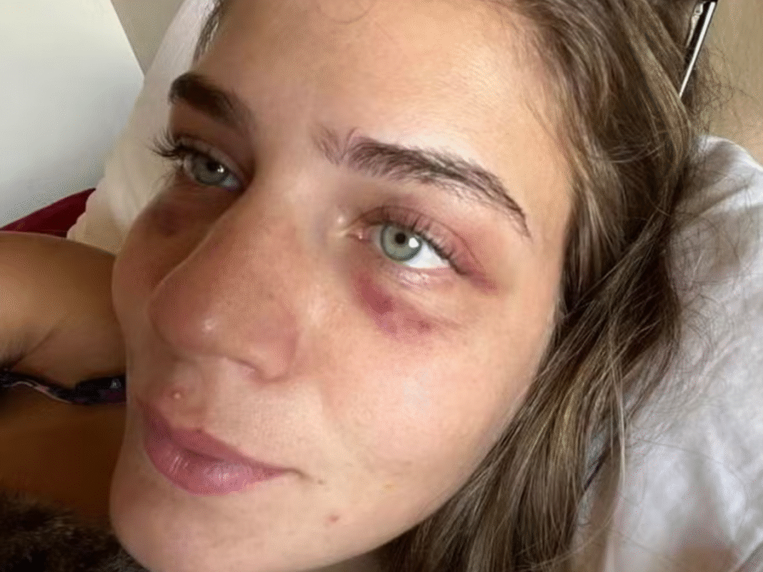 Ex-jogador é acusado de agressão por ex-namorada, mas decide não se manifestar; vídeo