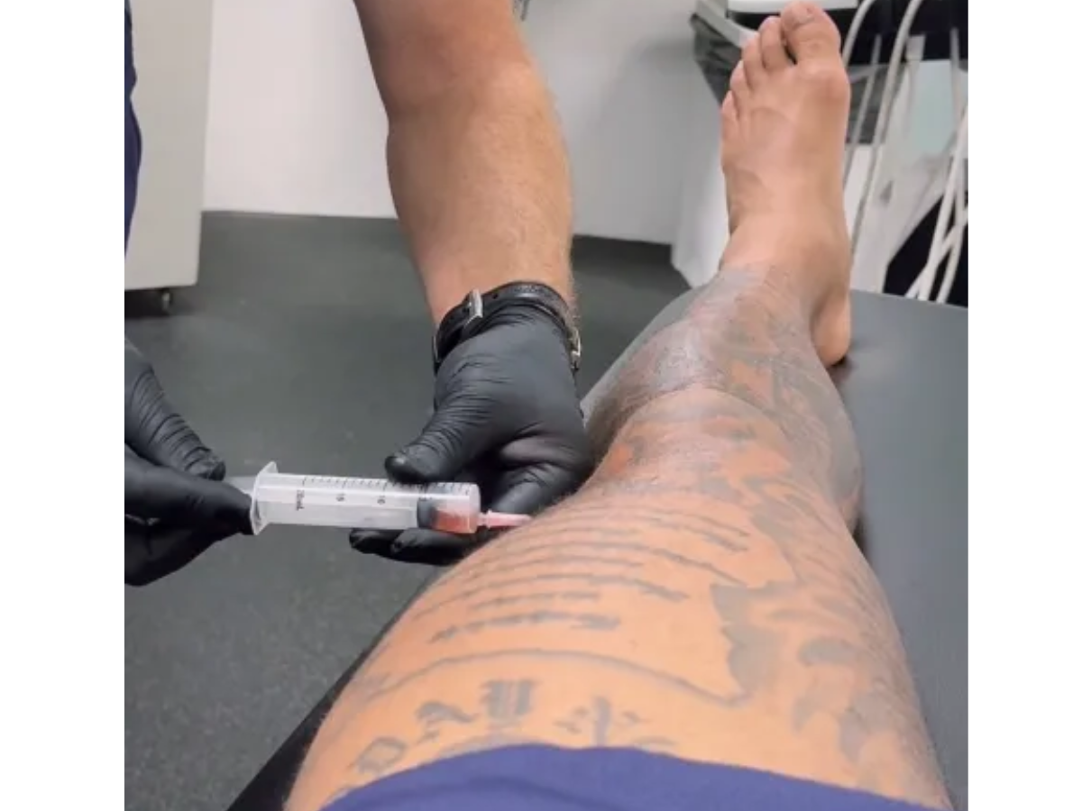 punção no joelho de Depay, do Corinthians