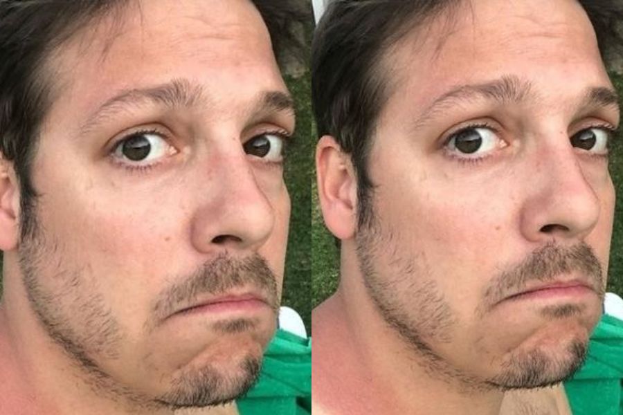 Fabio Porchat é sincero ao falar sobre sua rotina após cirurgia